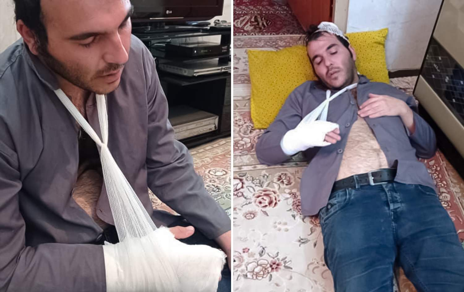 Photos show the injuries Hemin Jaleh sustained in custody of Iranian security forces. Photo: submitted